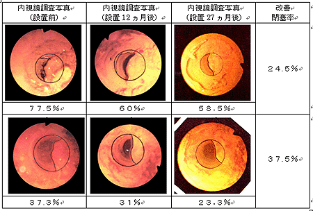 赤錆閉塞を確認する内視鏡調査写真A 設置前の赤錆閉塞率77.5% 設置後12ヶ月の赤錆閉塞率60% 設置後27ヶ月の赤錆閉塞率58.5% と、最終的に赤錆閉塞の改善率は、24.5%に 内視鏡調査写真B 設置前の赤錆閉塞率37.3% 設置後12ヶ月の赤錆閉塞率31% 設置後27ヶ月の赤錆閉塞率23.3% と、最終的に赤錆閉塞の改善率は、37.5%に